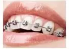 Your Path to Unrivaled Dental Care with the Best Dentist in Jaipur