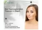 Best Hyperpigmentation Treatment in Aligarh | Regima Skin & Wellness Centre