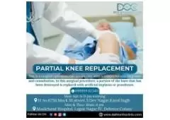 Best Knee Specialist in Delhi | Delhi Ortho Clinic