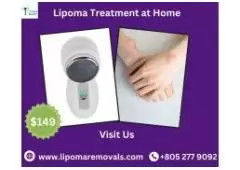 Explore the New Lipoma Treatment at an Affordable Price