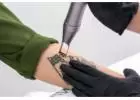 Revamp Your Look with Laser Tattoo Removal - Skinroots Clinic