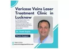 Varicose Veins Laser Treatment Clinic in Lucknow