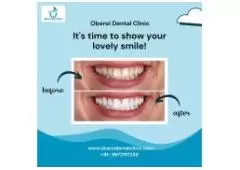 Show Your Lovely Smile - Oberoi Dental Clinic