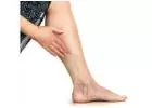  Leg Discoloration Due to Poor Circulation: What You Need to Know