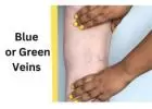 The Power of Blue or Green Veins: A Comprehensive Guide